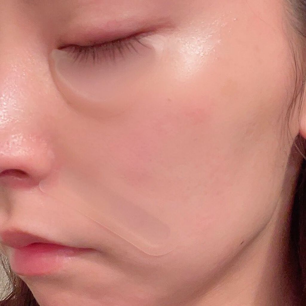 メディリフト 3Dマイクロフィラー(口元用)/YA-MAN TOKYO JAPAN/シートマスク・パックを使ったクチコミ(7枚目)