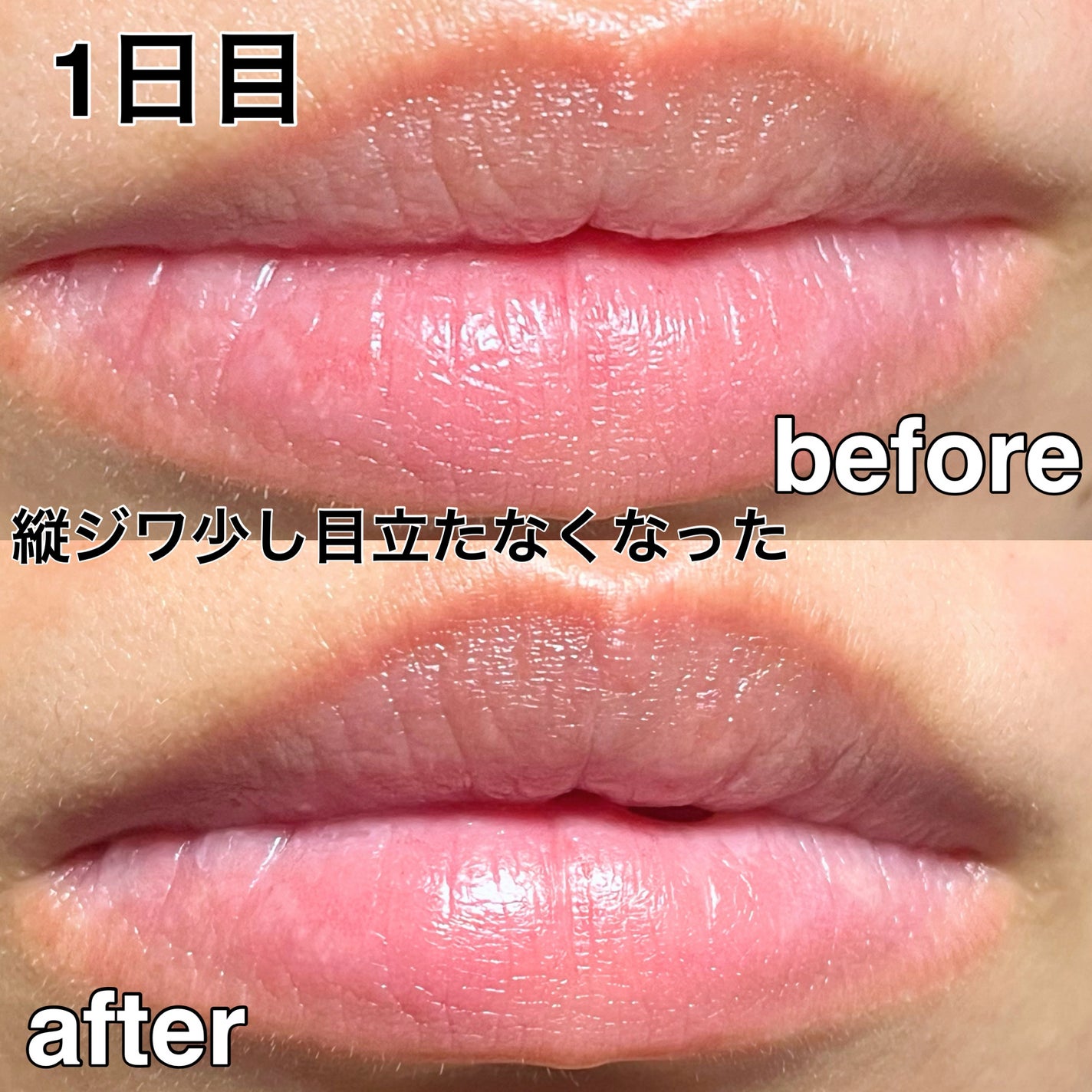 ゆーちゃか on LIPS 「どうにかしたい乾燥唇🫦プルプル唇パックでケアしてみた!・・・・..」(4枚目)