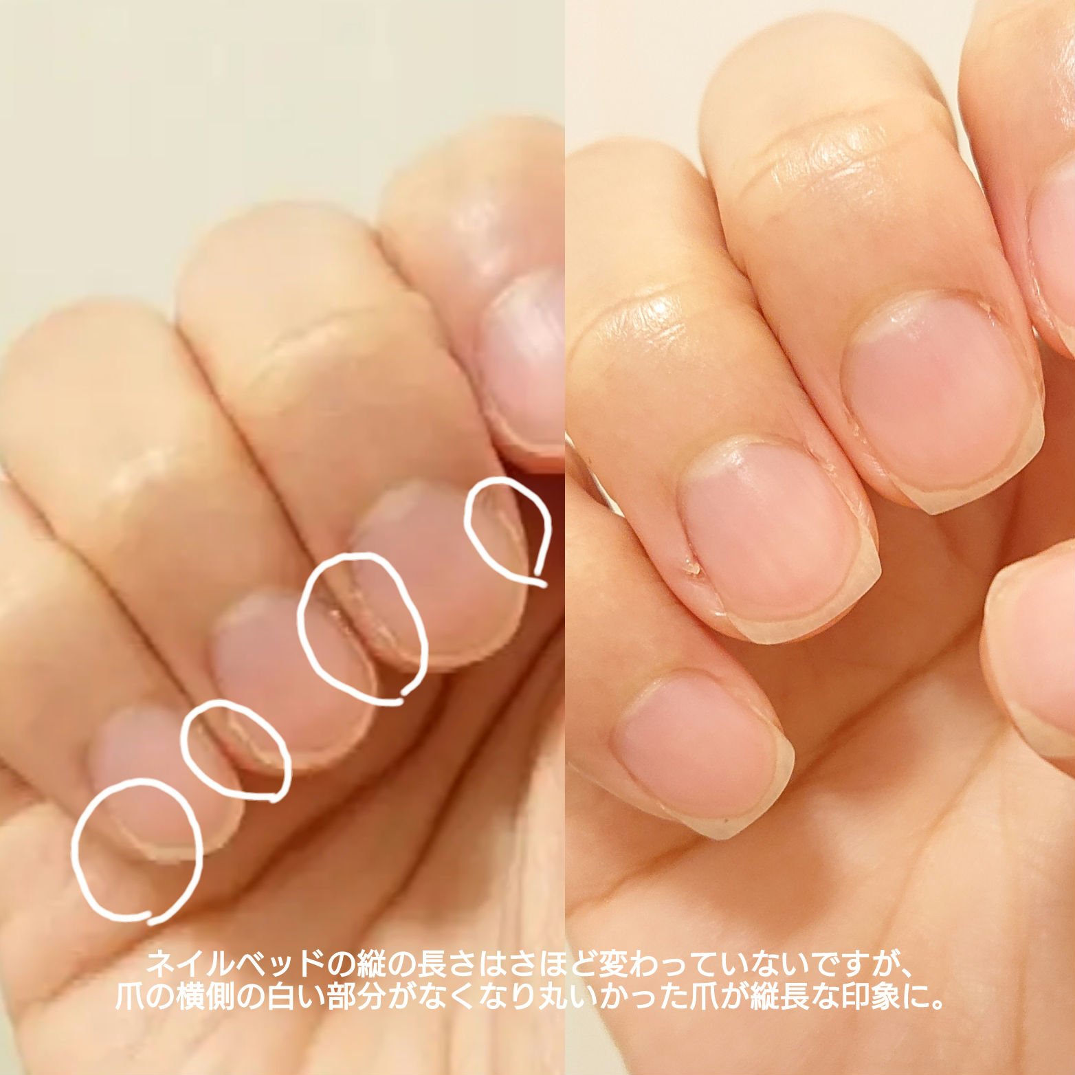 シア ネイルオイル/L&#39;OCCITANE/ネイルオイル・トリートメントを使ったクチコミ（3枚目）