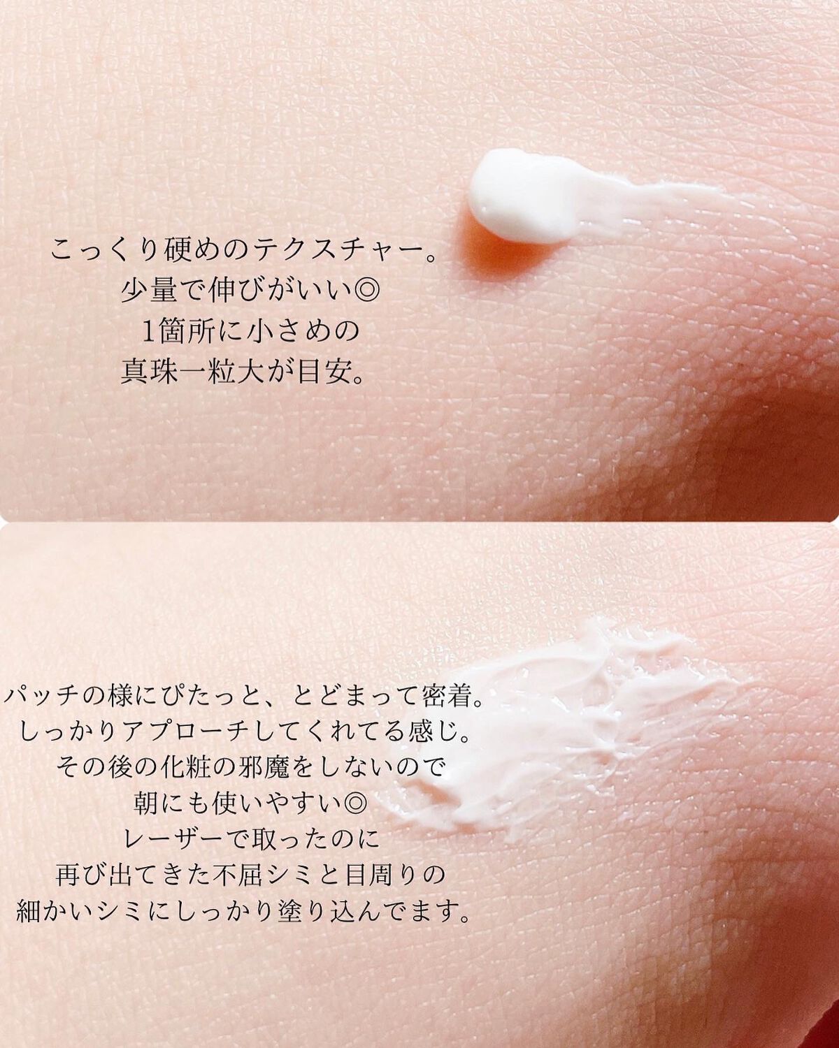 ホワイトショット SXS N/ホワイトショット/美容液を使ったクチコミ(2枚目)