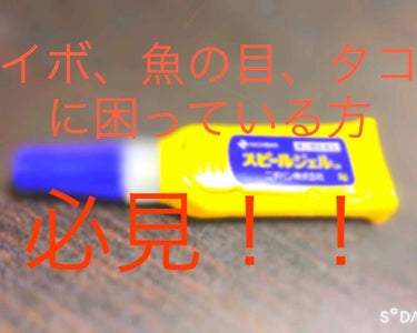 イボや魚の目、タコに困っている方必見‼️

今回ご紹介するのは
スピールジェル という薬です。

私は小さい頃からイボがあり困っていました😔何度か医者にも行って薬を処方してもらったのですがそれでも治らず