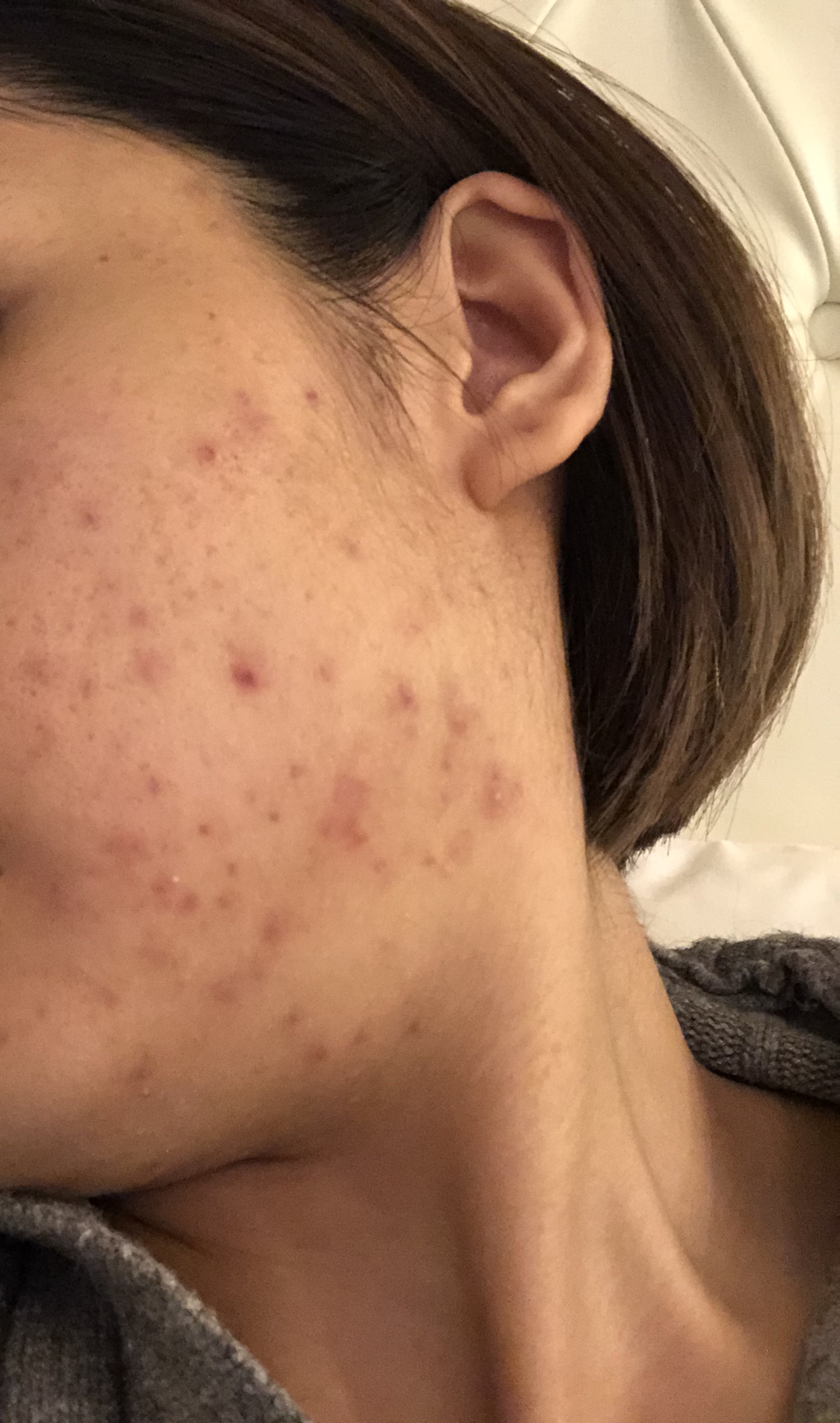 クレンジングソープ泡ホームケアLMT/LovemeTouch/泡洗顔を使ったクチコミ（3枚目）