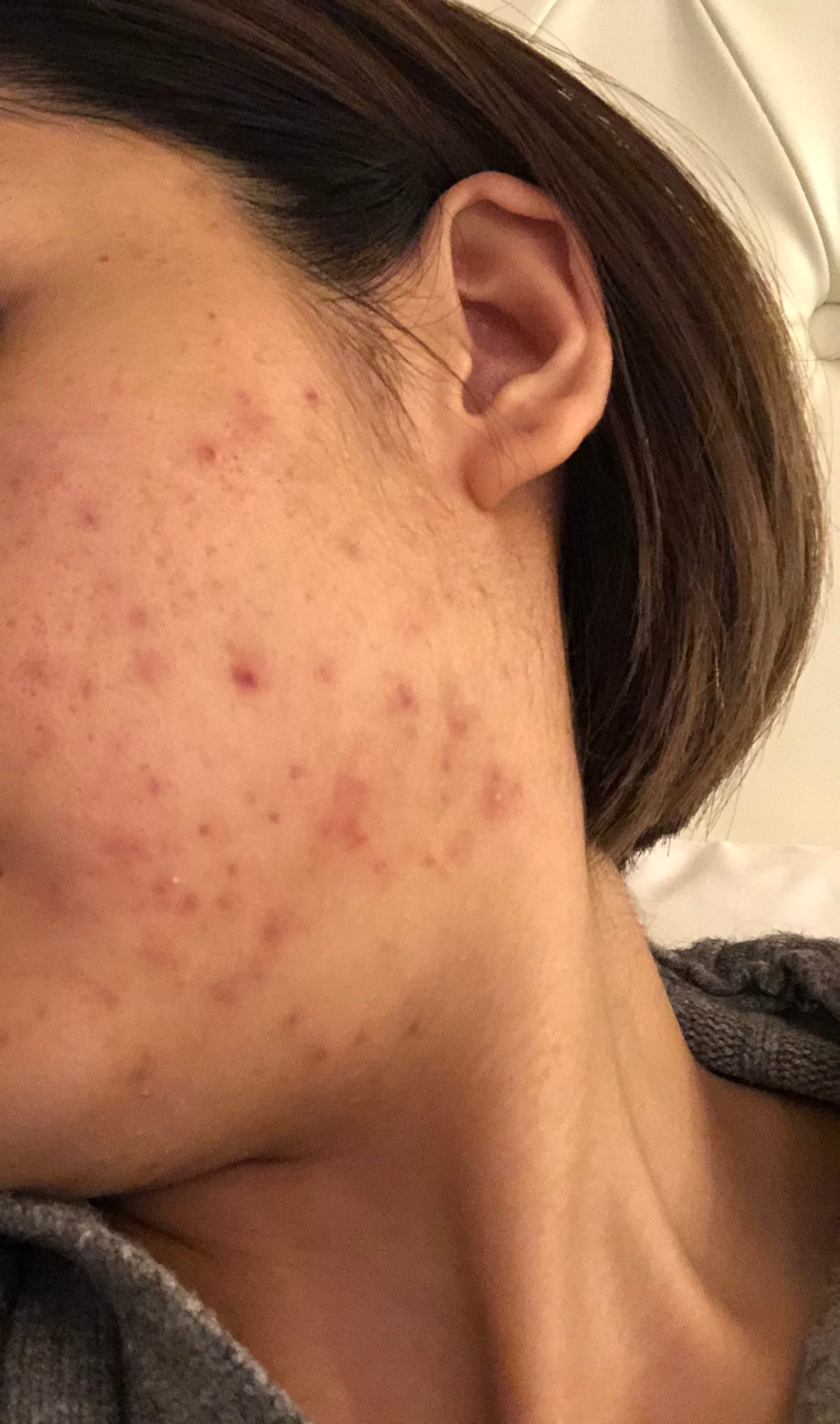 VC100エッセンスローション EX/ドクターシーラボⓇ/化粧水を使ったクチコミ(3枚目)