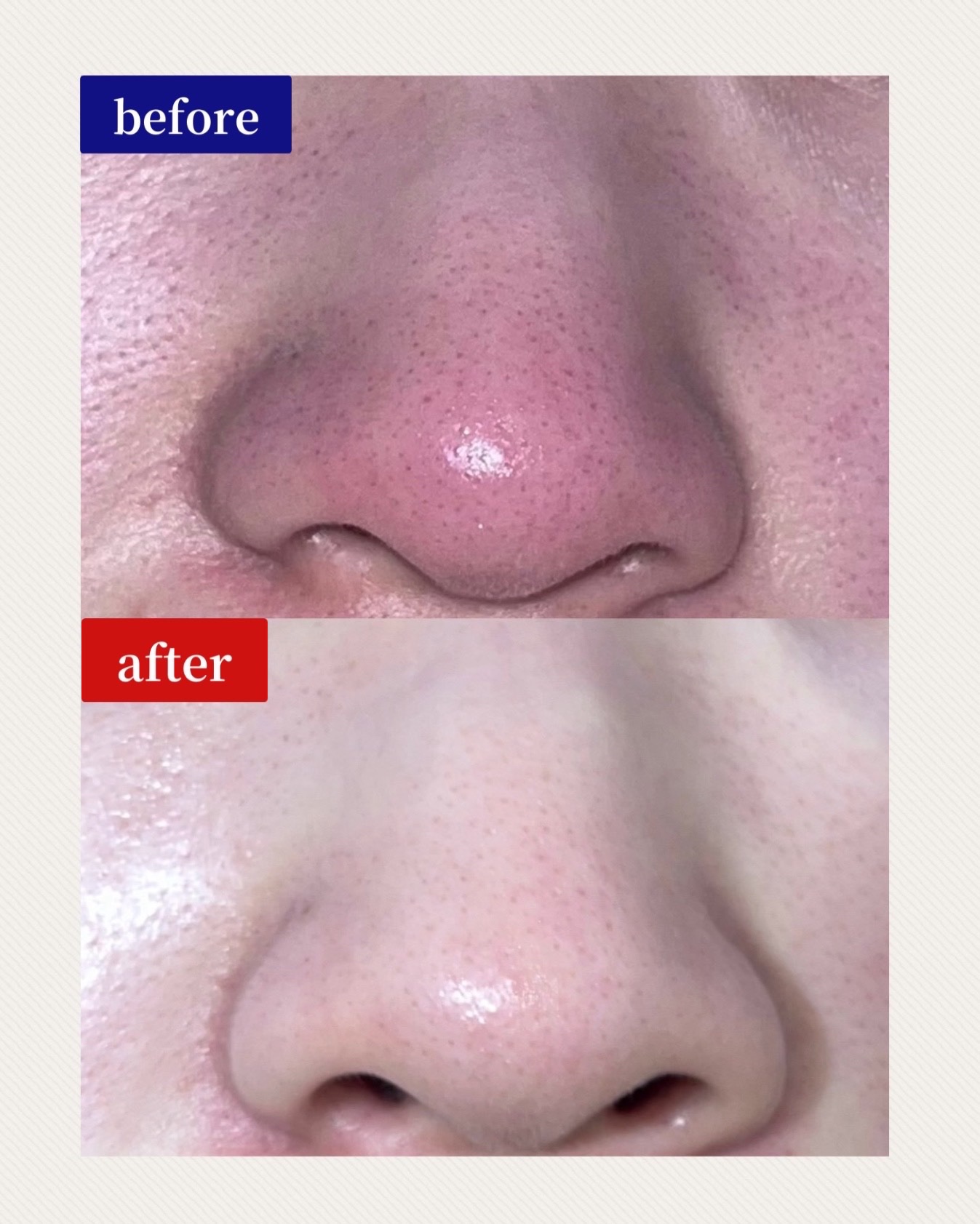 スペシャルパウダーソープCure/Cure/洗顔パウダーを使ったクチコミ（2枚目）