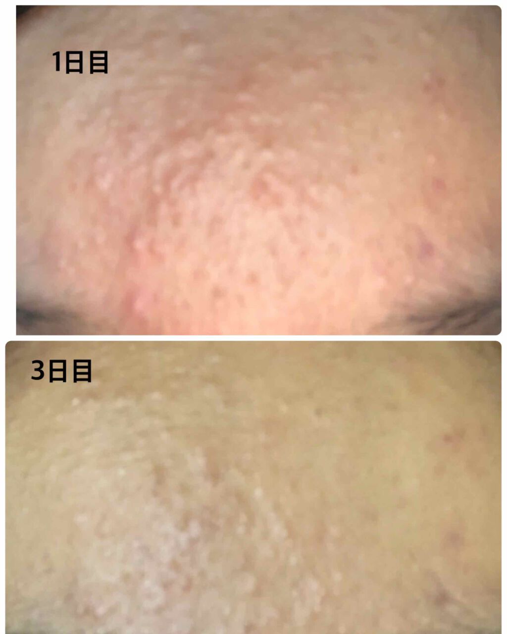 を使ったクチコミ（2枚目）