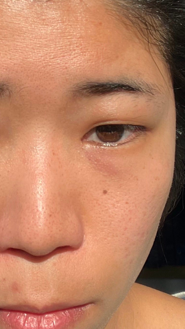 𐐪𝓐𝓴𝓲𐑂 on LIPS 「🔺汚い肌と顔が出てきます。注意してください。私は重い一重で子供..」(2枚目)