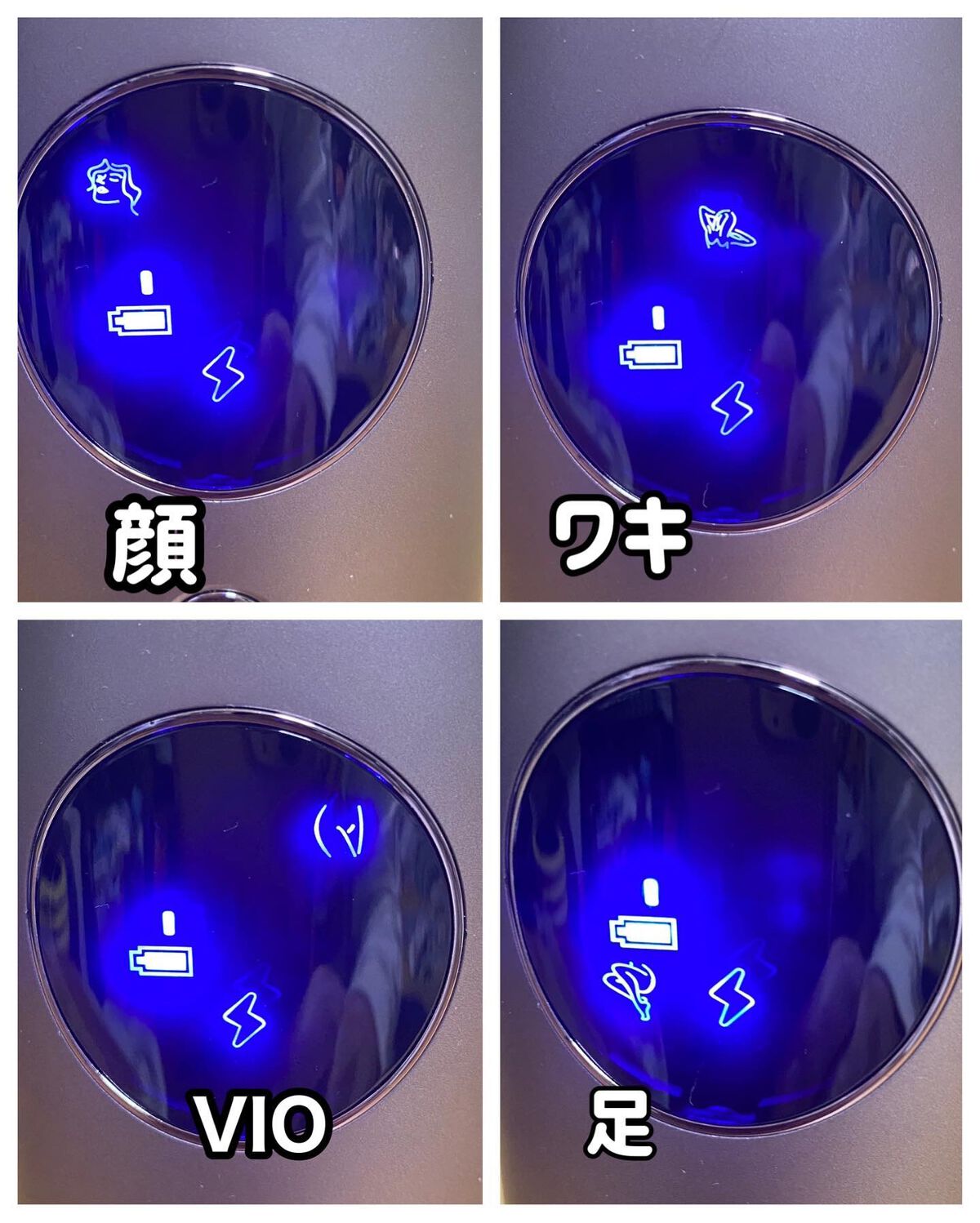 コードレス脱毛器/Noend/家庭用脱毛器を使ったクチコミ(2枚目)