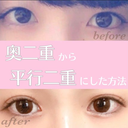 ふたえテープ 目立たず肌になじむ絆創膏タイプ/DAISO/二重まぶた用アイテムを使ったクチコミ(1枚目)