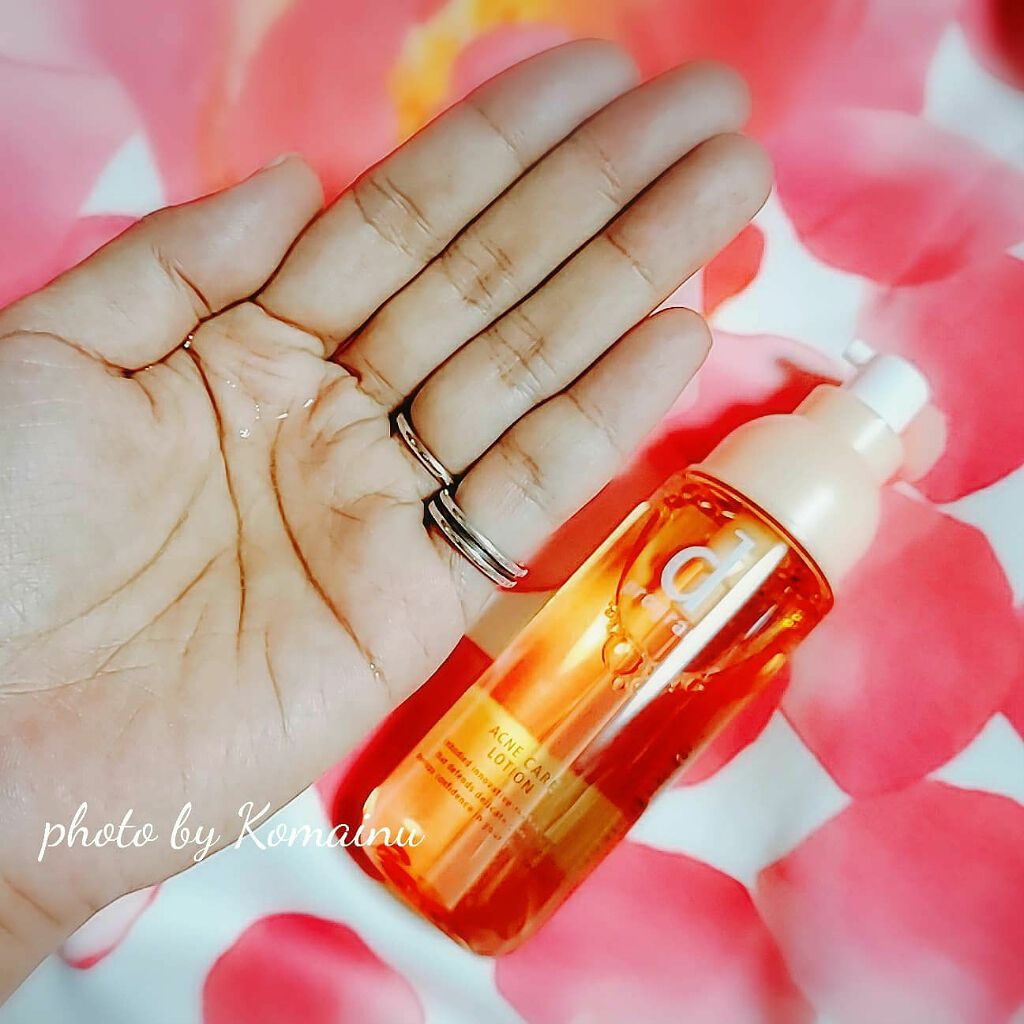 アクネケア ローション MB/d プログラム/化粧水を使ったクチコミ（3枚目）