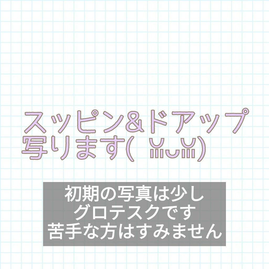 プロステージ VC100 ビタミンC モイスチャーローションリッチ/ナチュリア/化粧水を使ったクチコミ(2枚目)