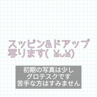 プロステージ VC100 ビタミンC モイスチャーローションリッチ/ナチュリア/化粧水を使ったクチコミ（2枚目）