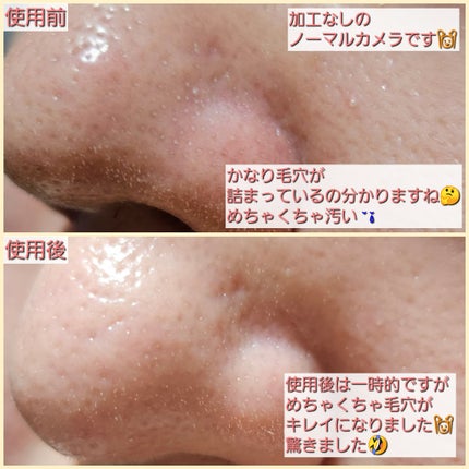 extra super 9+/MEDIPEEL/その他スキンケアを使ったクチコミ(6枚目)