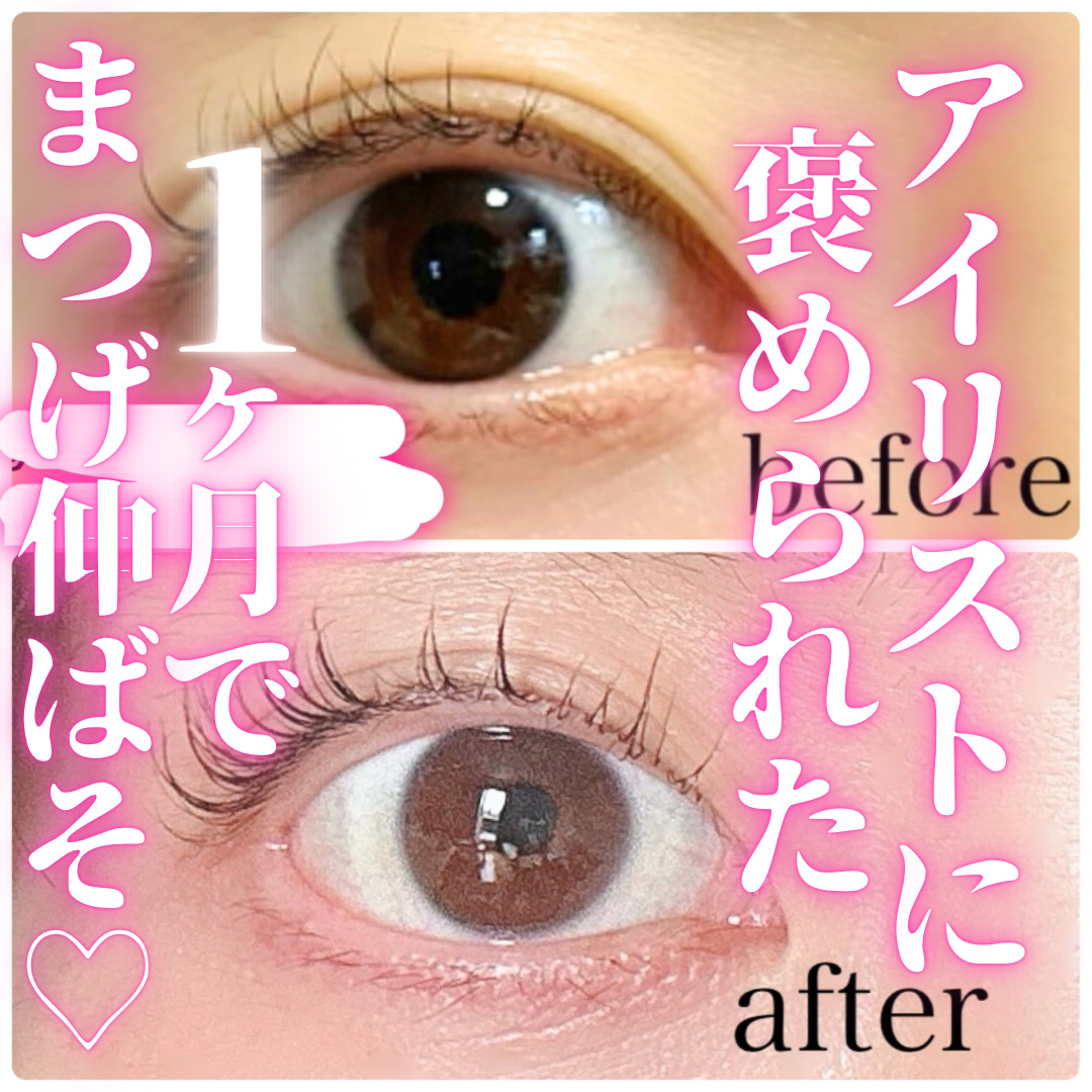 【1ヶ月でここまで伸ばしたまつ毛ケア方✨】

こんにちは　ゆきたん　です😊

第3子妊娠中、つわり等の体調不良でまつ毛ケアをおろそかにしていたゆきたん。
ホルモンの影響もありますが、案の定まつ毛の量や長さが少し落ち込んでしまいました。

