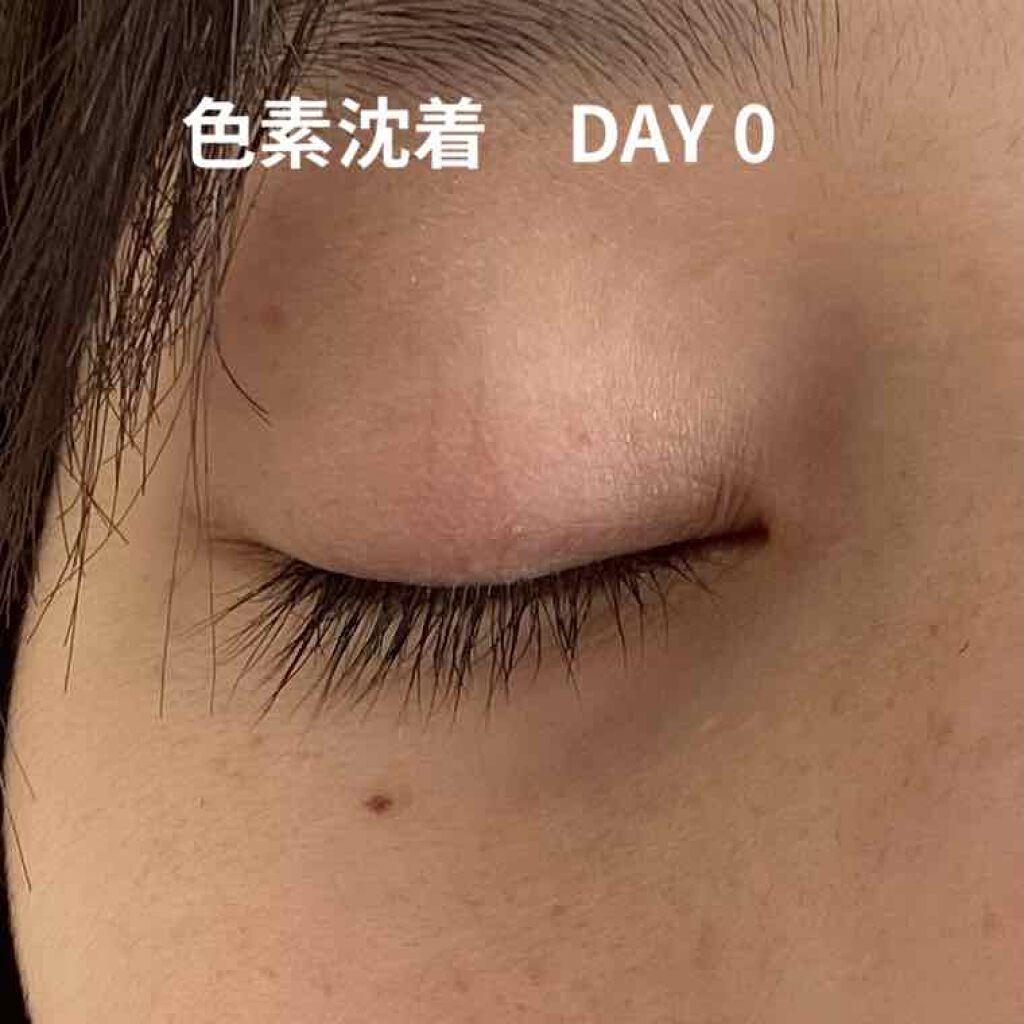 ハイチオールCホワイティア(医薬品)/ハイチオールC/その他を使ったクチコミ（3枚目）