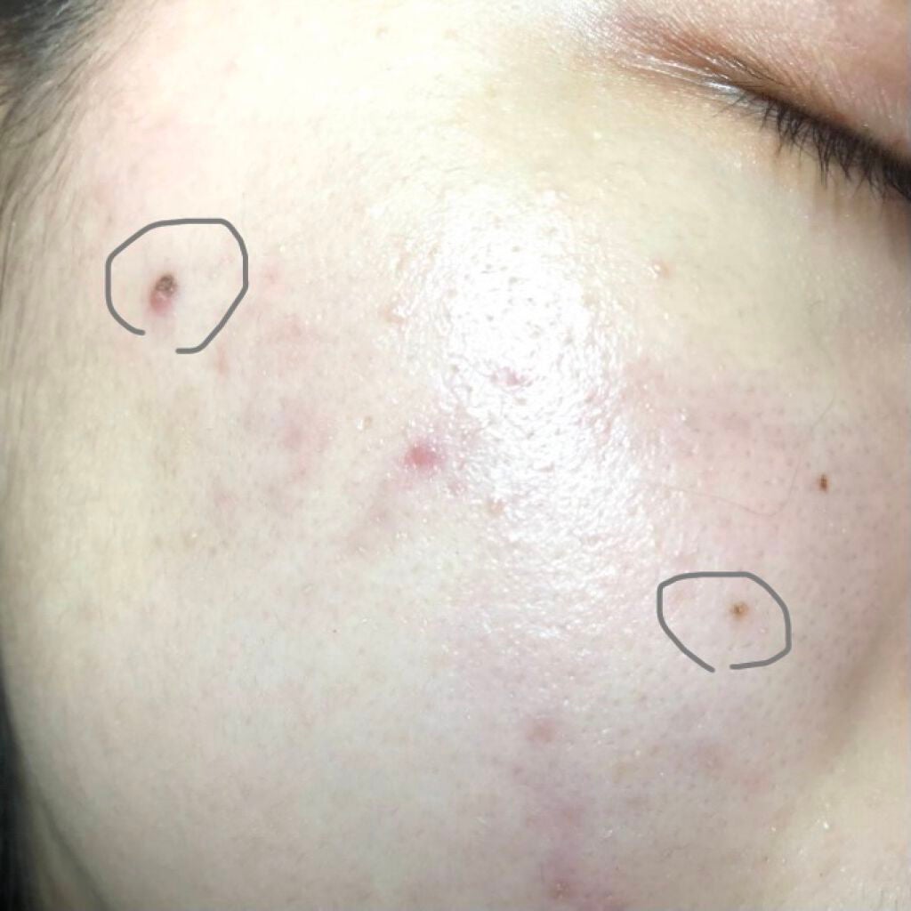 モイストバランス  ローション/ACSEINE/化粧水を使ったクチコミ(2枚目)