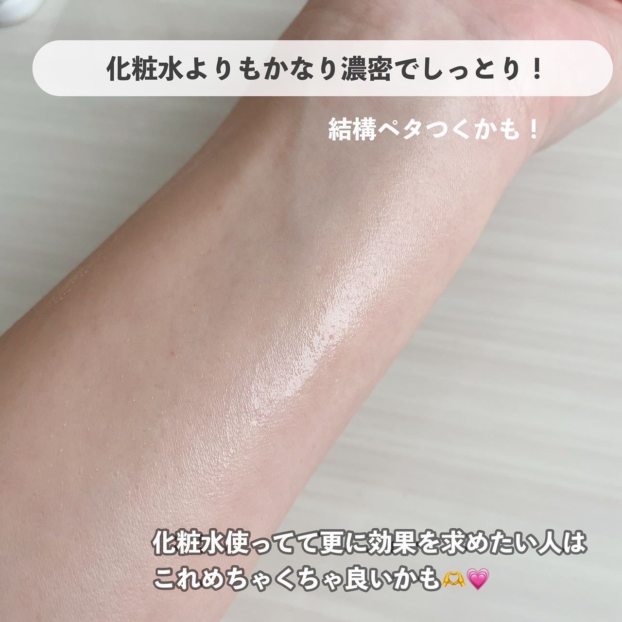 ダーマレーザー スーパーVC100ローション(しっとり)/クオリティファースト/化粧水を使ったクチコミ(9枚目)