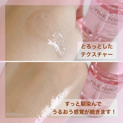 ピンクティーツリーシナジーセラム/APLIN/美容液を使ったクチコミ(5枚目)