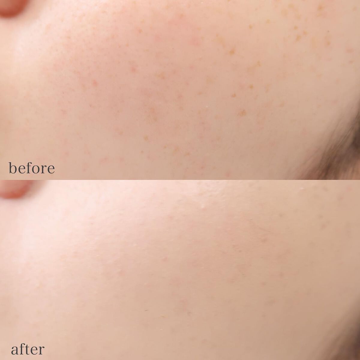 ロングラスティングコンシールフィクシングクッション /LUNA/クッションファンデーションを使ったクチコミ(5枚目)