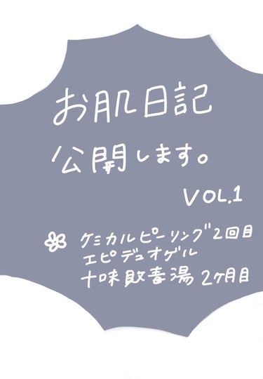 サンソリット スキンピールバー ティートゥリーのクチコミ「【お肌日記vol.1】

30代目前に
いまだにニキビ(もうそう呼べる年齢ではない)と
格闘し.....」（1枚目）