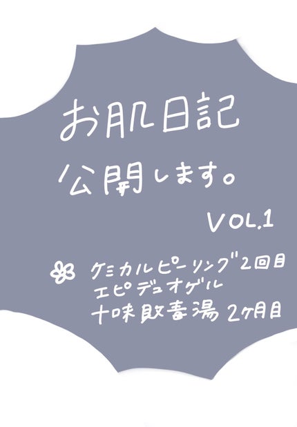 スキンピールバー ティートゥリー/サンソリット/洗顔石鹸を使ったクチコミ(1枚目)