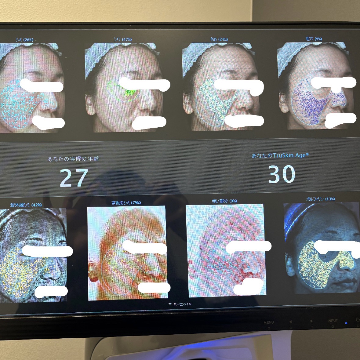 DRX AZAクリア/ロート製薬/その他スキンケアを使ったクチコミ（2枚目）