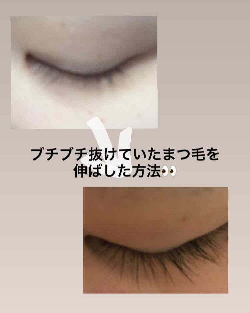 EMAKED(エマーキット)/水橋保寿堂製薬/まつげ美容液を使ったクチコミ(1枚目)