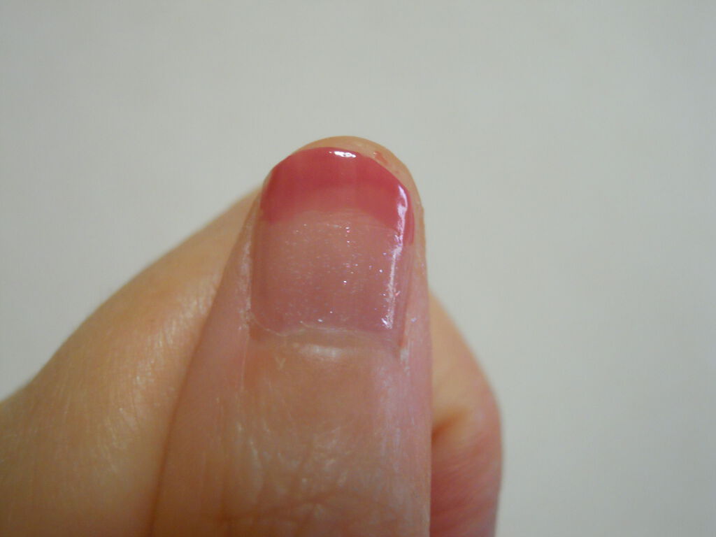 きーちゃん on LIPS 「簡単にネイルオフできるのがこの百均で買えるネイル落としです(^..」(2枚目)