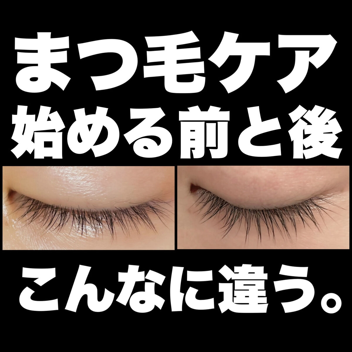 アーニストアイラッシュセラム/BENTON/まつげ美容液を使ったクチコミ（1枚目）