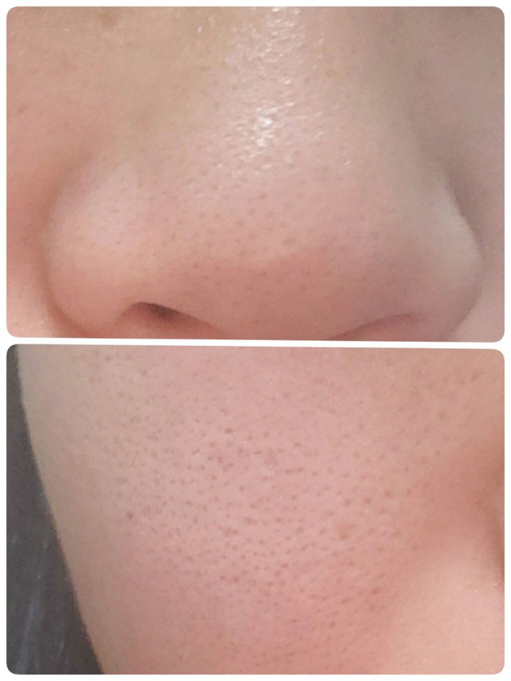 ロゼットゴマージュ/ロゼット/ピーリングを使ったクチコミ（2枚目）