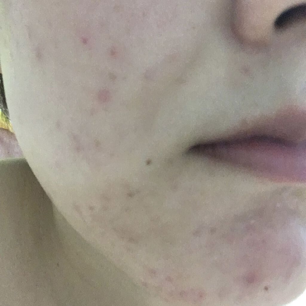 ビジャ シカバーム EX/innisfree/フェイスバームを使ったクチコミ（2枚目）