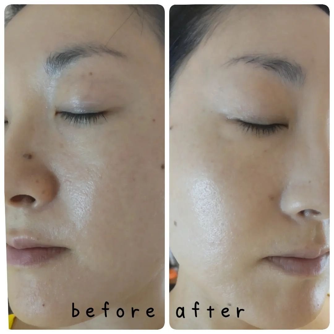 タンイドル ウルトラ ウェア リキッド/LANCOME/リキッドファンデーションを使ったクチコミ(4枚目)