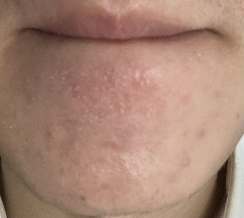 UVイデア XL プロテクショントーンアップ/ラ ロッシュ ポゼ/日焼け止めクリームを使ったクチコミ（2枚目）