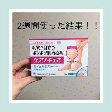ケアノキュア 医薬品 小林製薬の口コミ このケアノキュアを使い続けて2週間がたった By ズボラ母 乾燥肌 Lips