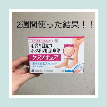 ケアノキュア（医薬品）/小林製薬/その他を使ったクチコミ（1枚目）