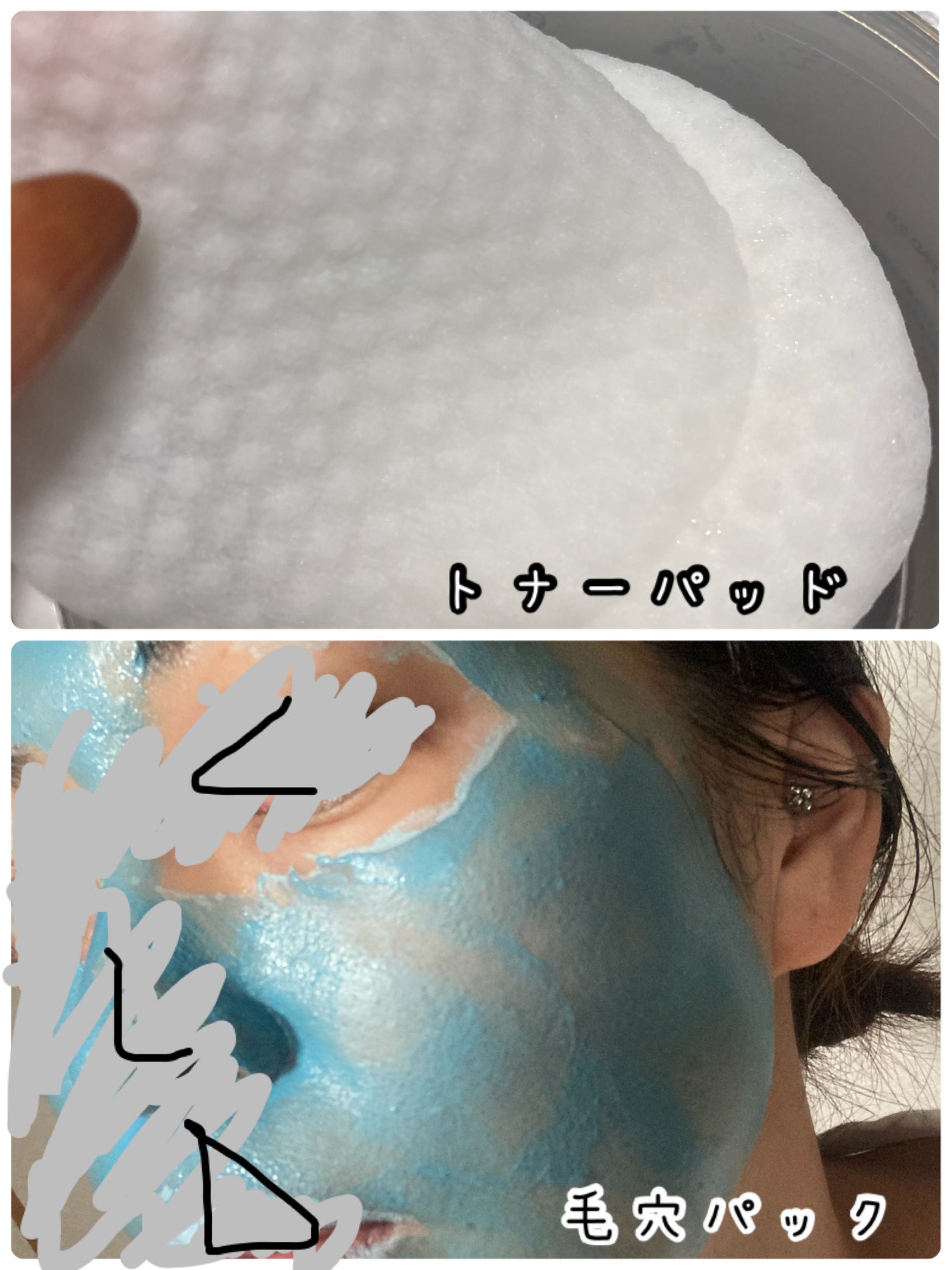 ゼロ毛穴パッド 2.0/MEDICUBE/トナーパッドを使ったクチコミ(4枚目)