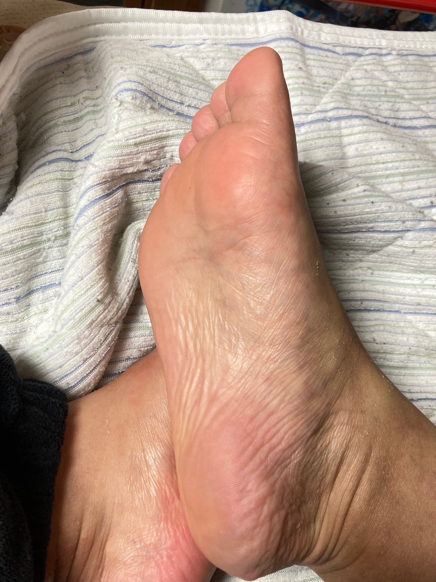 ふわふわマシュマロフット/リベルタ/レッグ・フットケアを使ったクチコミ(4枚目)