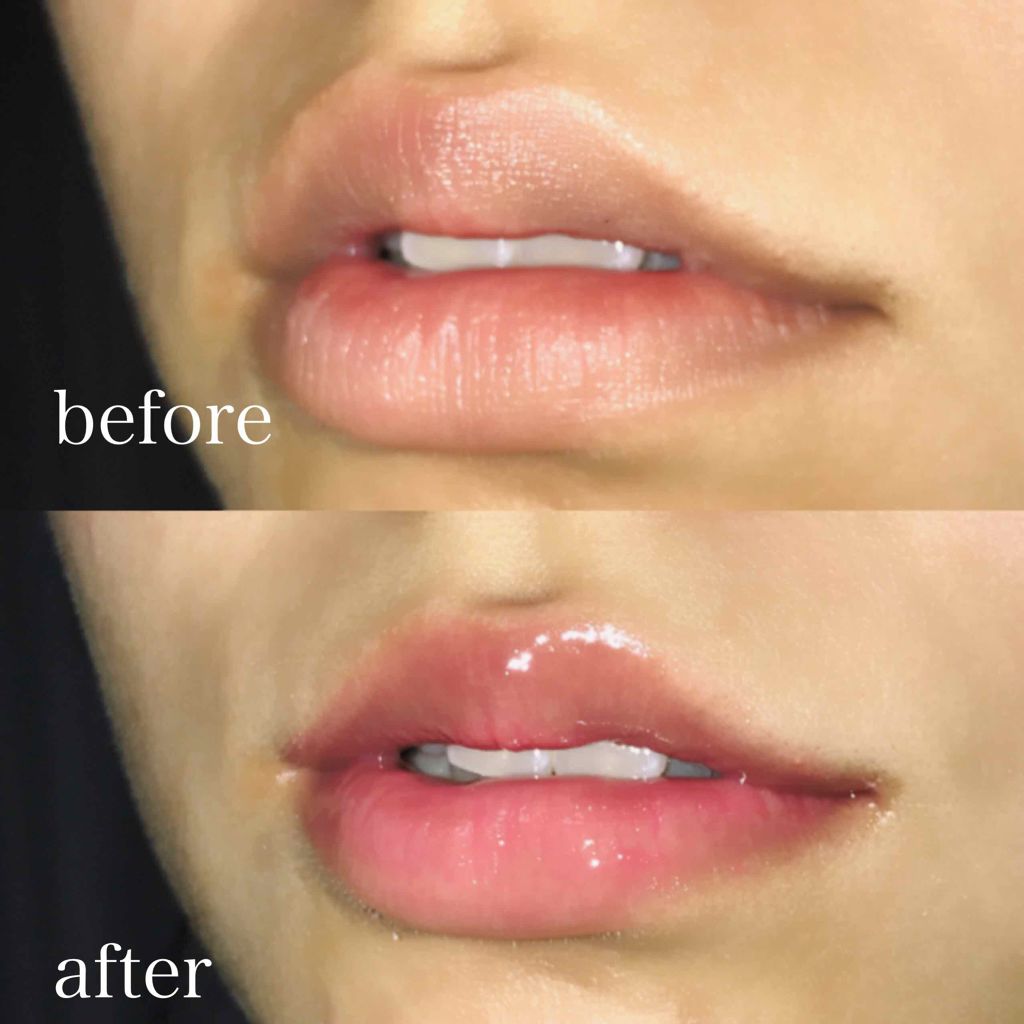 ディオール アディクト リップ グロウ オイル/Dior/リップグロスを使ったクチコミ(3枚目)