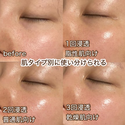 ヴィーガンコンブチャ ティー エッセンス/Dr.Ceuracle/オールインワン化粧品を使ったクチコミ(7枚目)