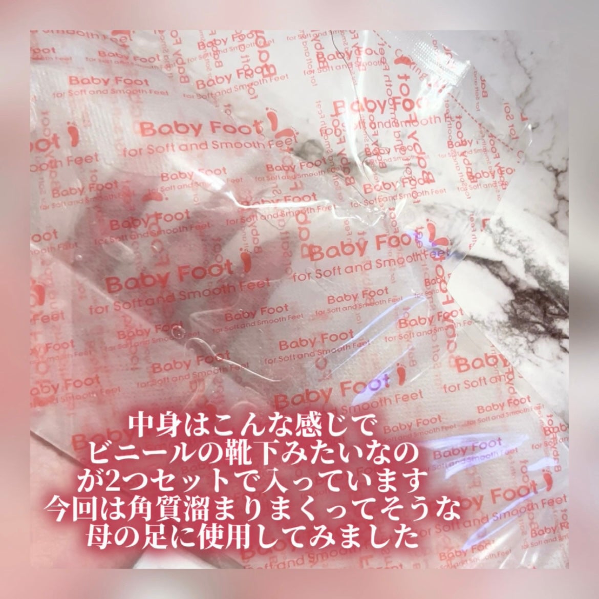 イージーパックDP60分タイプ/ベビーフット/レッグ・フットケアを使ったクチコミ(2枚目)