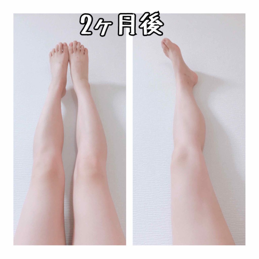 寝ながらメディキュット スパッツ 骨盤テーピング/メディキュット/着圧ソックス・レギンスを使ったクチコミ（3枚目）