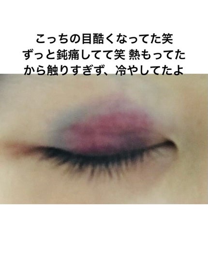 べあ@sjk on LIPS 「春休み真っ只中、整形シーズン!ということで普段投稿あまりしない..」(9枚目)