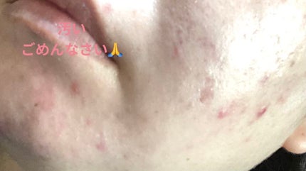 24 ミネラルUVコンシーラー/24h cosme/パレットコンシーラーを使ったクチコミ(4枚目)