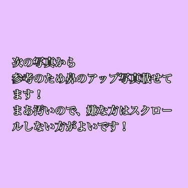 明色スキンコンディショニング 明色スキンコンディショナーのクチコミ「【グリセリンフリー】１ヶ月(スキンケアだけ)グリセリンフリーにしてみた結果の投稿です！


<.....」（2枚目）