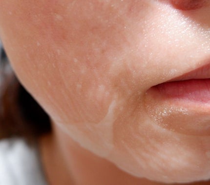 リソウ リペアプレミアムマスク/リソウコーポレーション/シートマスク・パックを使ったクチコミ(4枚目)