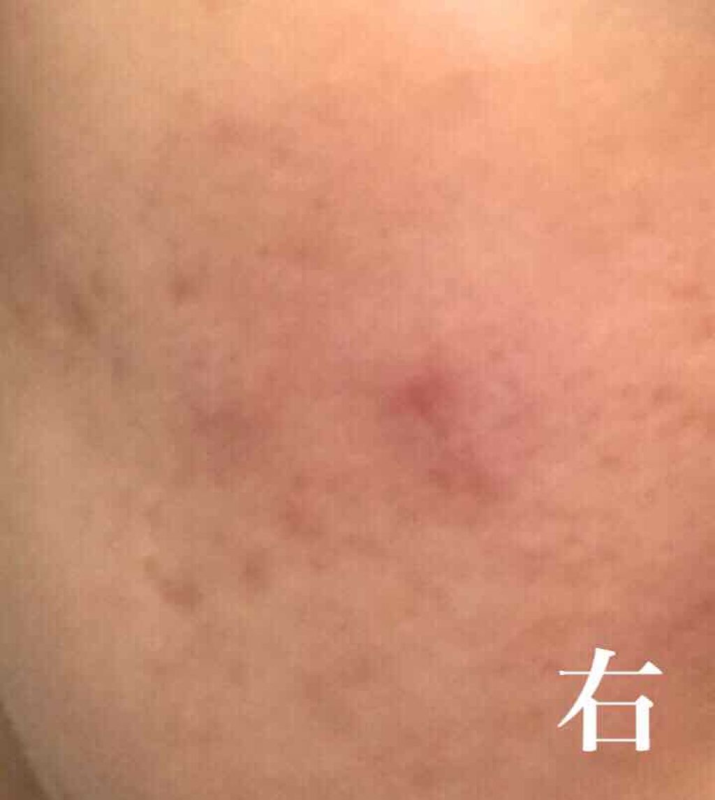 ロゼット洗顔パスタ 海泥スムース/ロゼット/洗顔フォームを使ったクチコミ（2枚目）