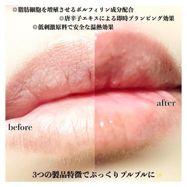 True Beauty Kiss Lip Plumper/all my things/リップグロスを使ったクチコミ（9枚目）