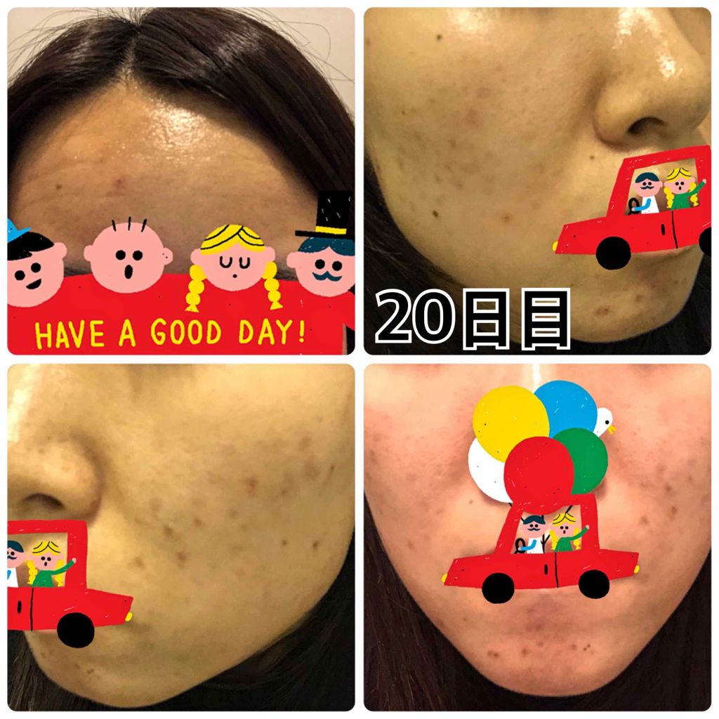 マイルドクレンジング オイル/ファンケル/オイルクレンジングを使ったクチコミ(3枚目)