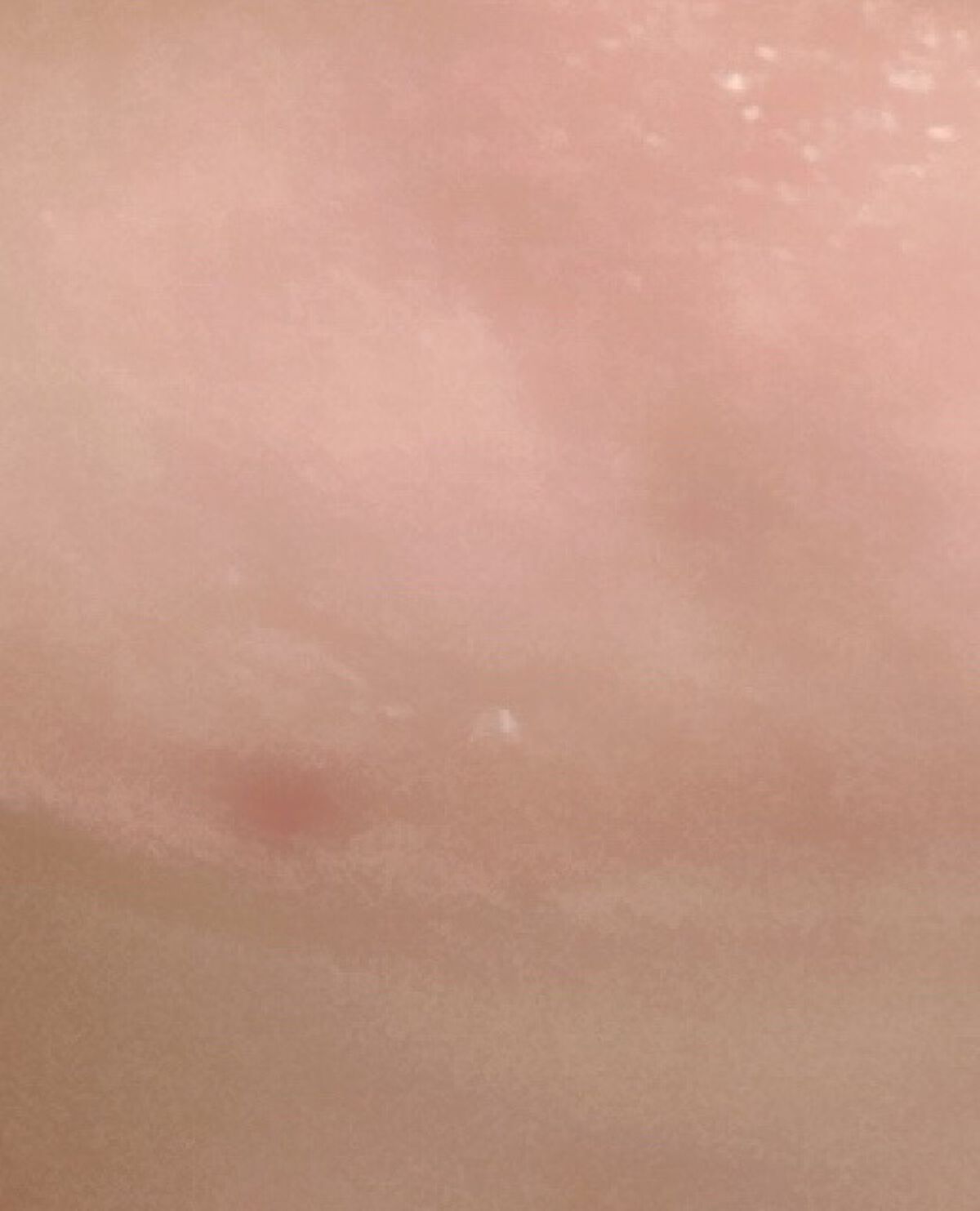 ミノン アミノモイスト 薬用マイルド ホワイトニング/ミノン/美容液を使ったクチコミ（2枚目）