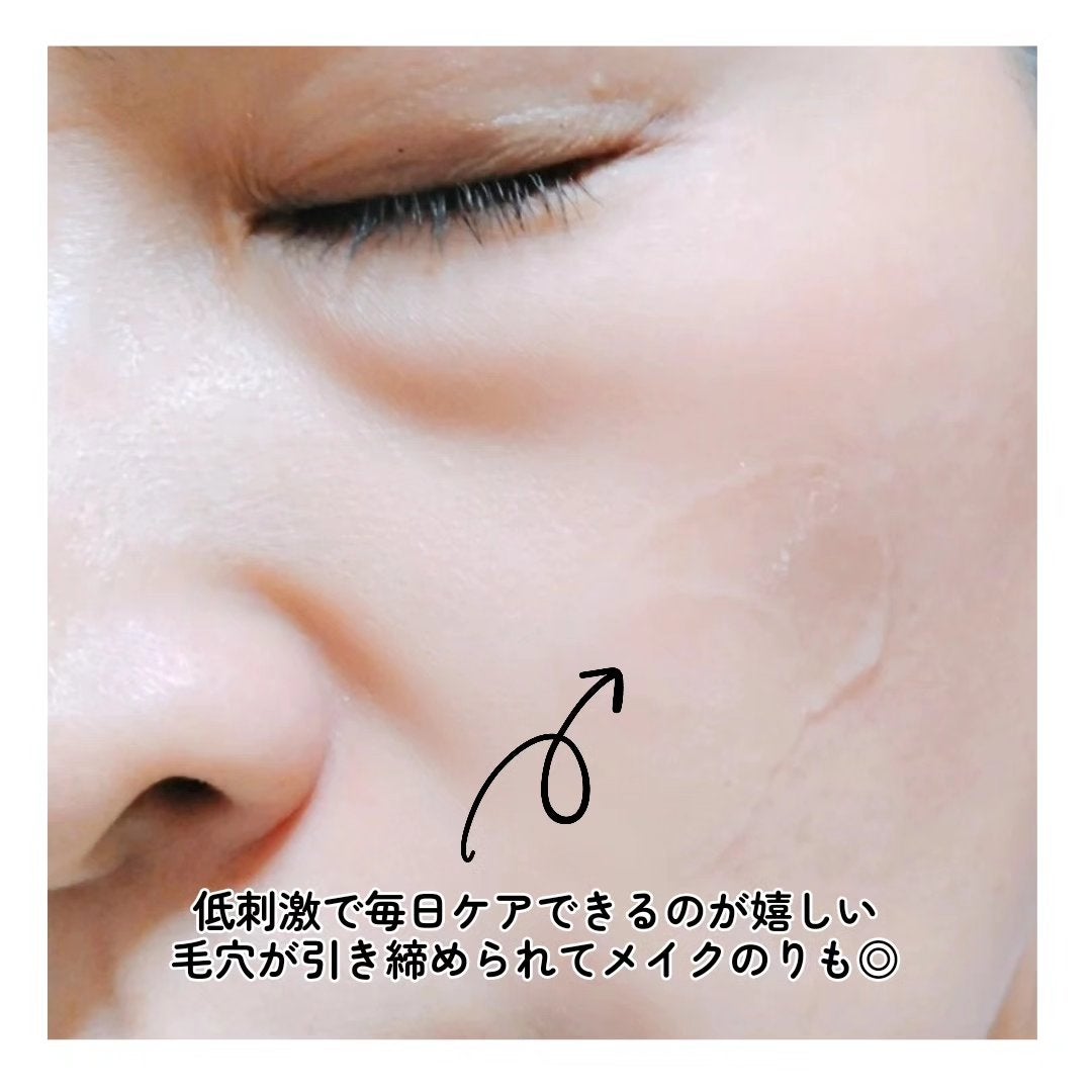 ゼロ1DAYエクソソームショット2000/MEDICUBE/美容液を使ったクチコミ(6枚目)