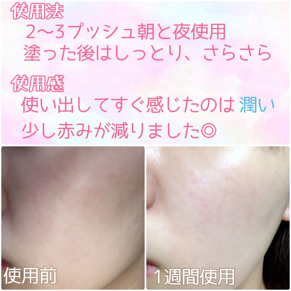 キャビアドットブースター/DEW/ブースター・導入液を使ったクチコミ(2枚目)